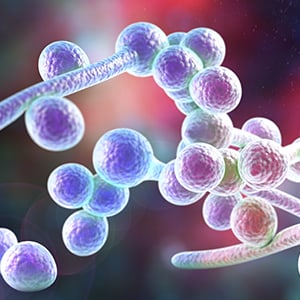 Microscopic image of a yeast infection. Redness is one of the many symptoms of yeast infections.